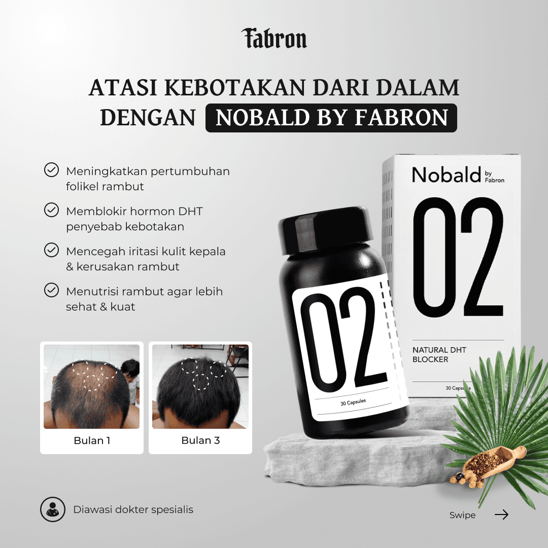 obat kebotakan, no bald