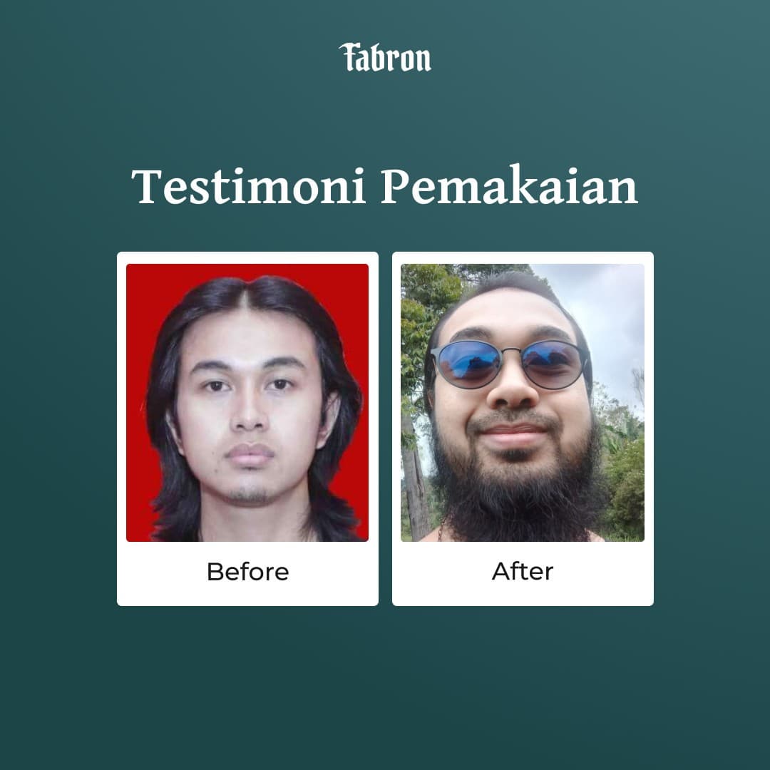 (e-voucher) X Serum - Beard Starter Treatment