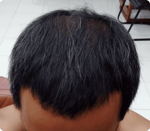 testi 1