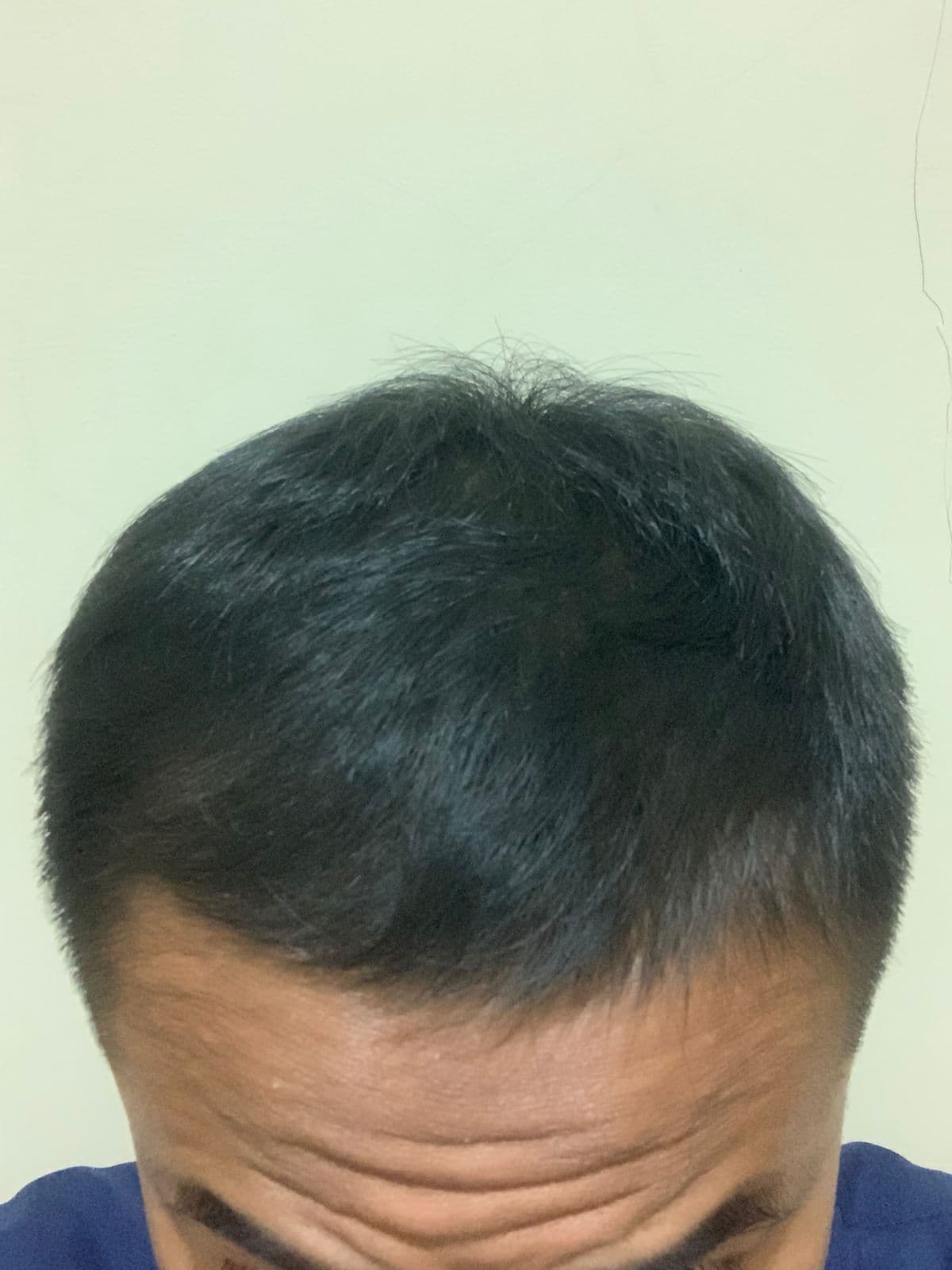 After - Fahmi