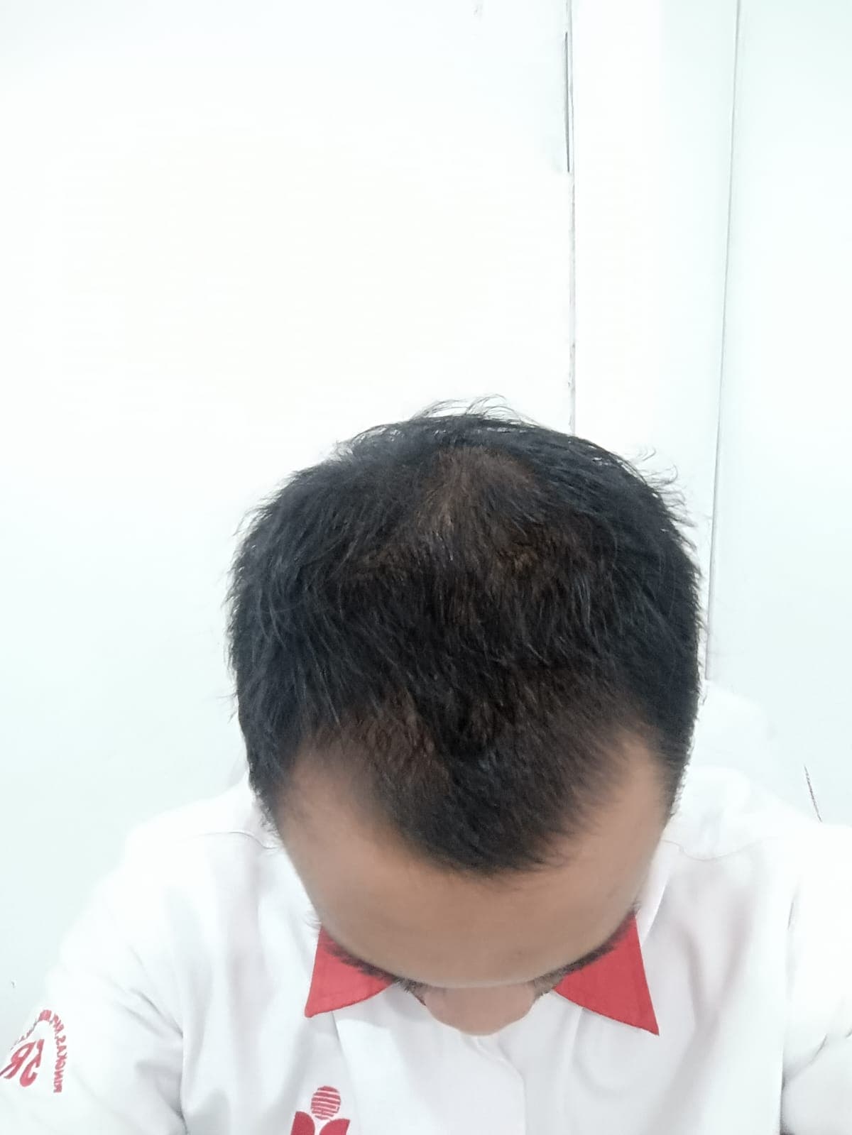 After - Fahri