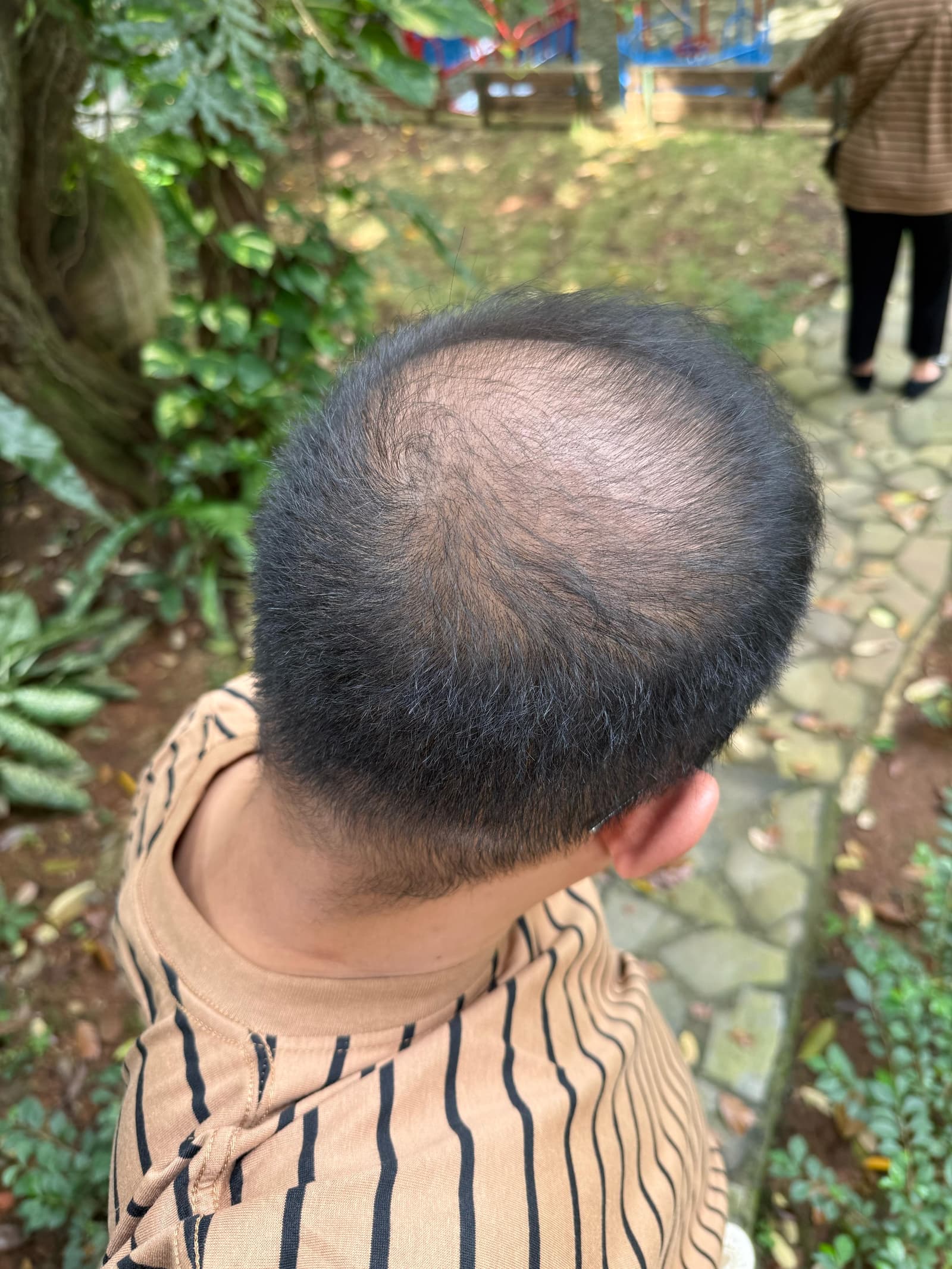 After - Fajri