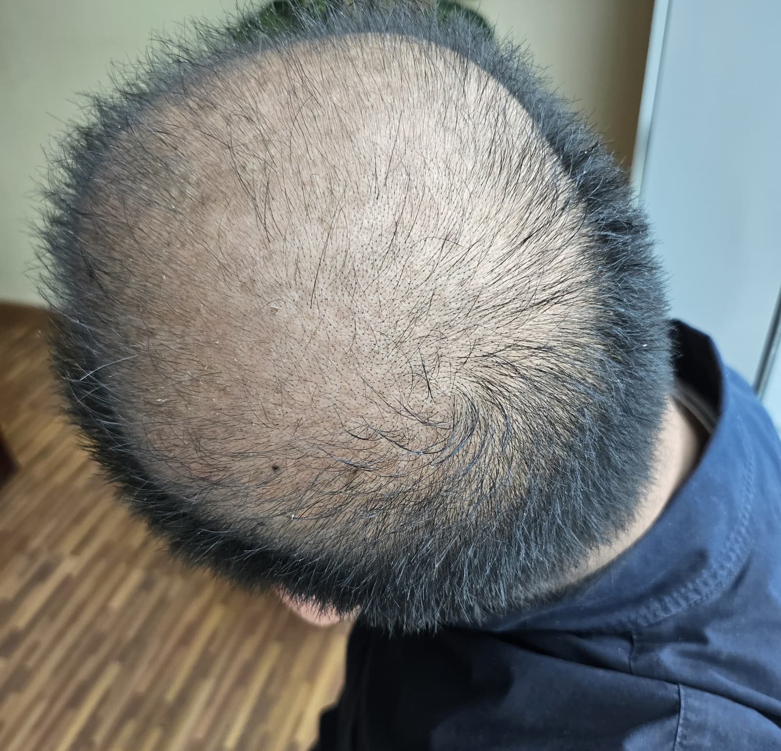Before - Fajri