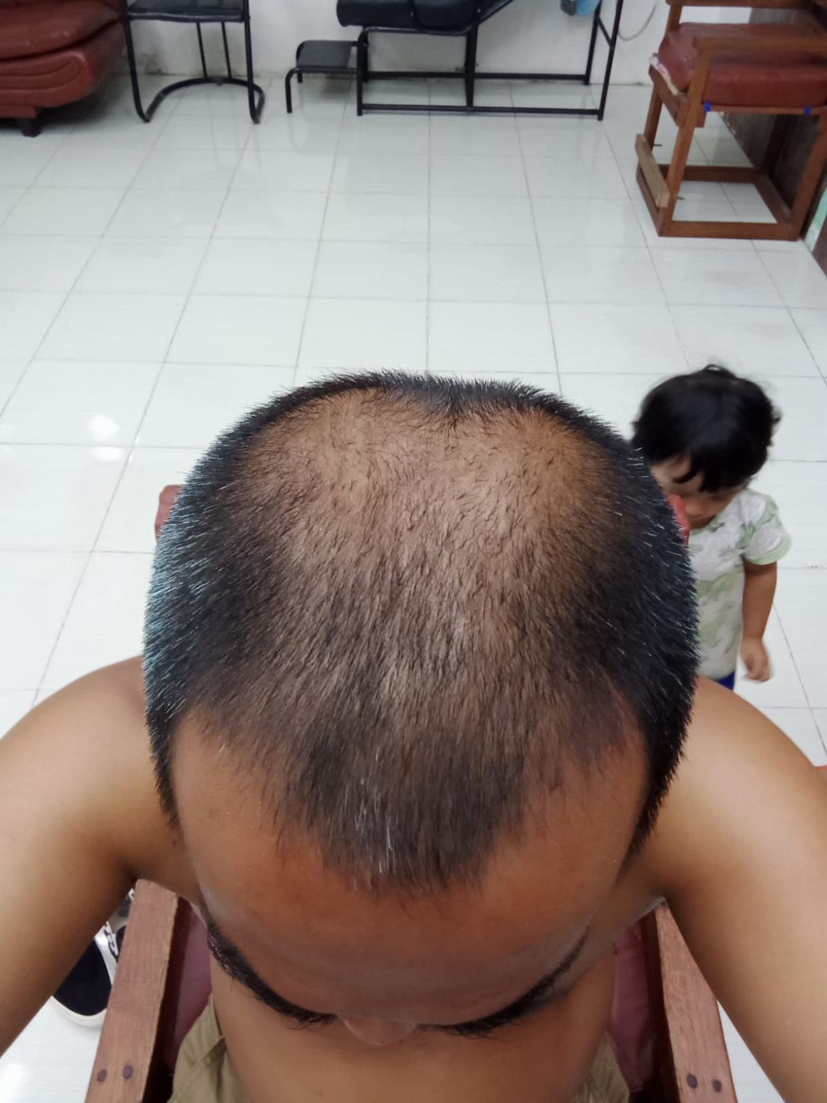 Before - Sholihin